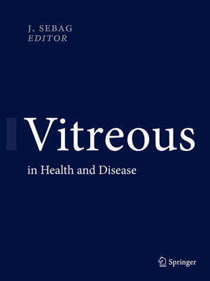 cover image of Vitreous